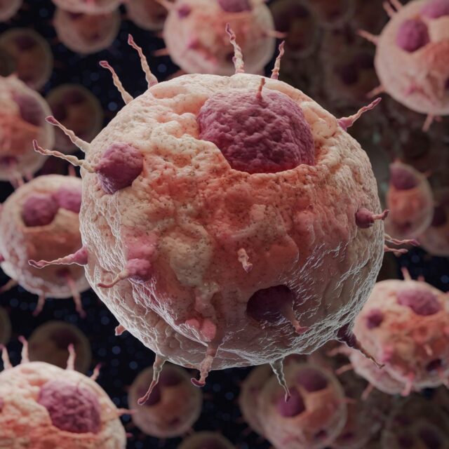 Nuestros defensores: Los Linfocitos Celula maligna - cancer